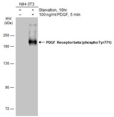 Western Blot: PDGF R beta [p Tyr771] Antibody [NBP3-13250] - Untreated (-) and treated (+) NIH-3T3 whole cell extracts (30 ug) were separated by 7.5% SDS-PAGE, and the membrane was blotted with PDGF R beta (phospho Tyr771) antibody (NBP3-13250) diluted at 1:1000. The HRP-conjugated anti-rabbit IgG antibody (NBP2-19301) was used to detect the primary antibody.